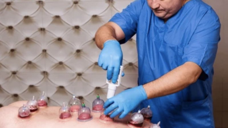 Los Angeles Online and Live Hijama Course