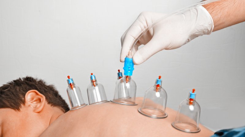 What is a hijama practitioner?