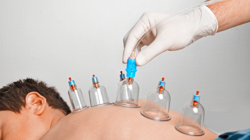 Miami Hijama Course